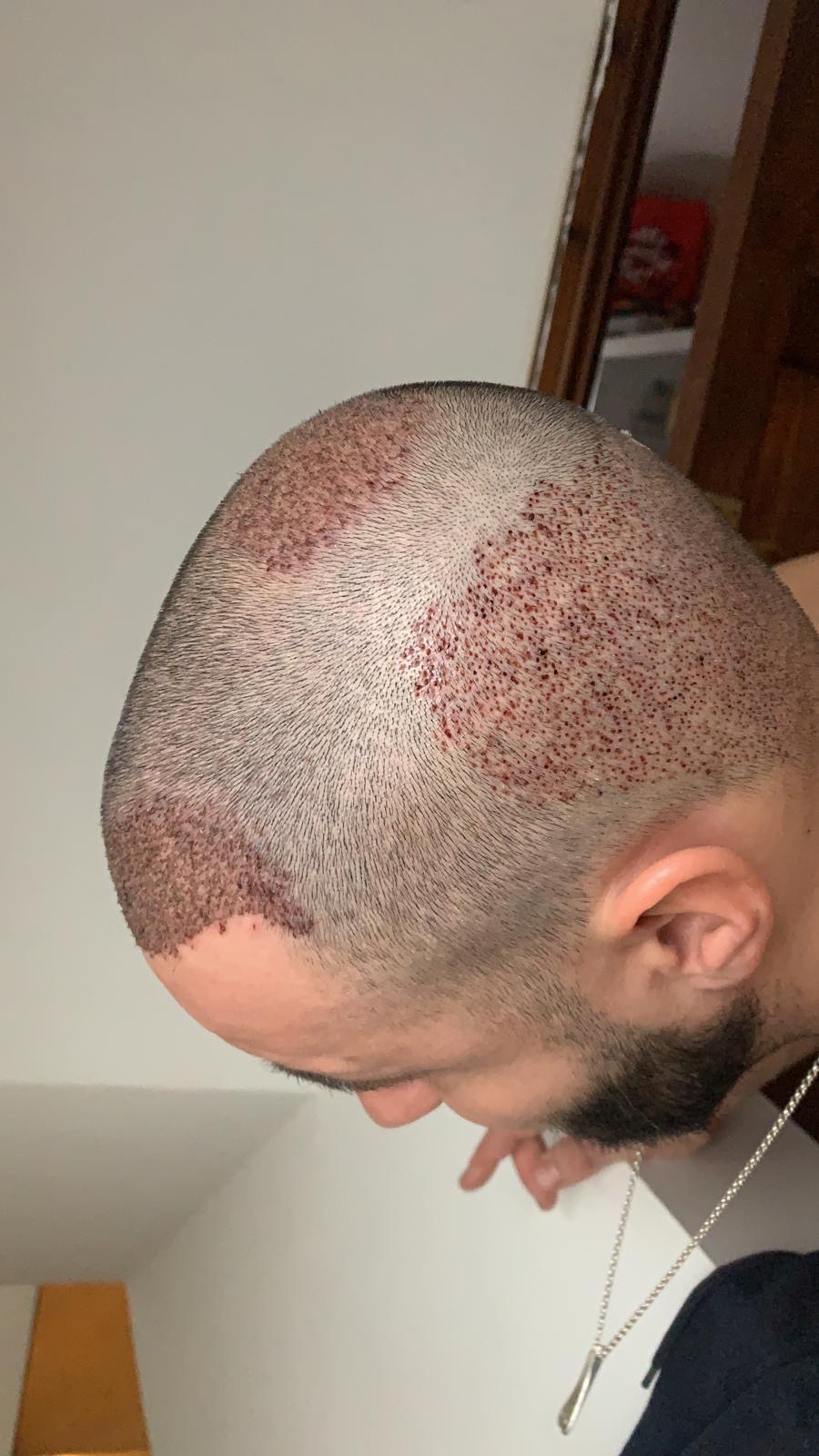 /foren/transplant/index.php/fa/51366/0/