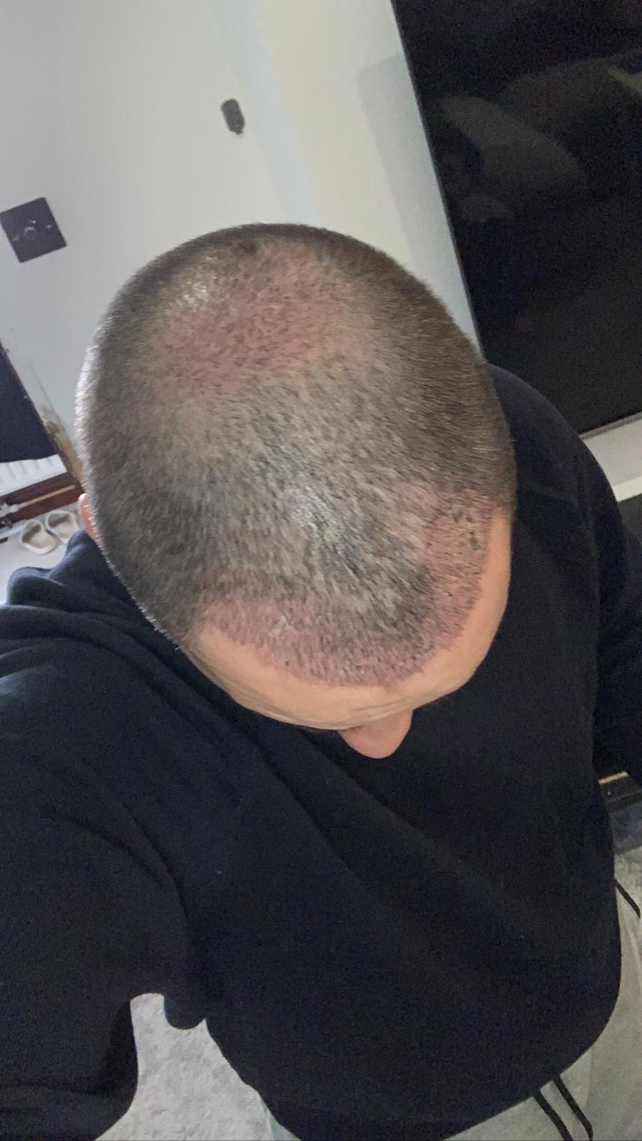 /foren/transplant/index.php/fa/51369/0/