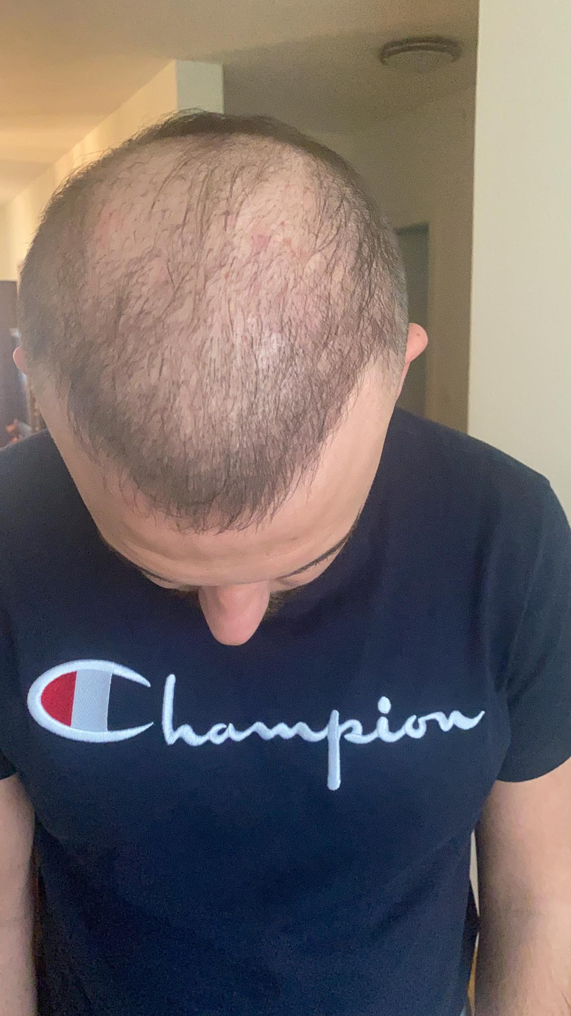 /foren/transplant/index.php/fa/51378/0/