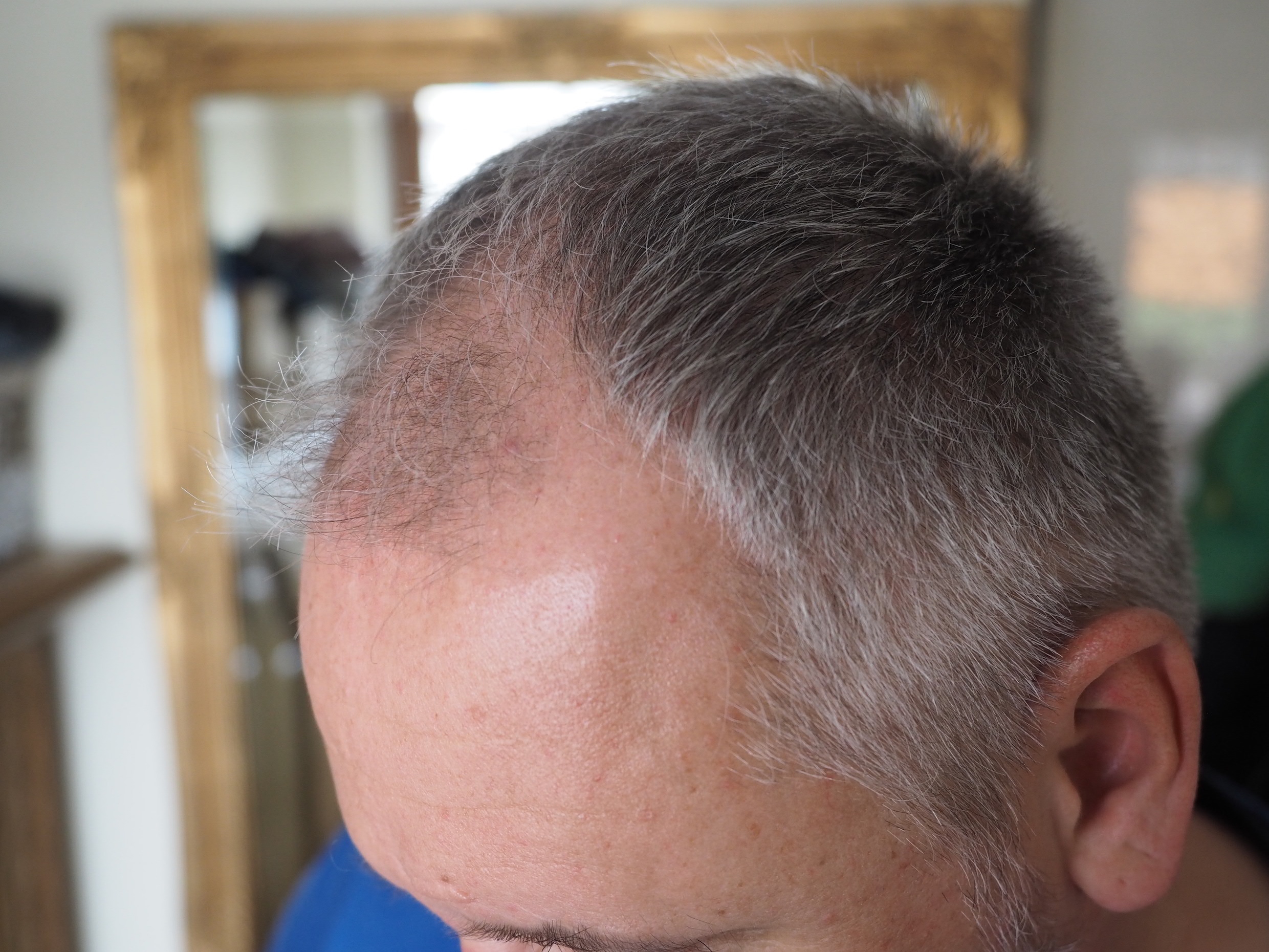 /foren/transplant/index.php/fa/51393/0/