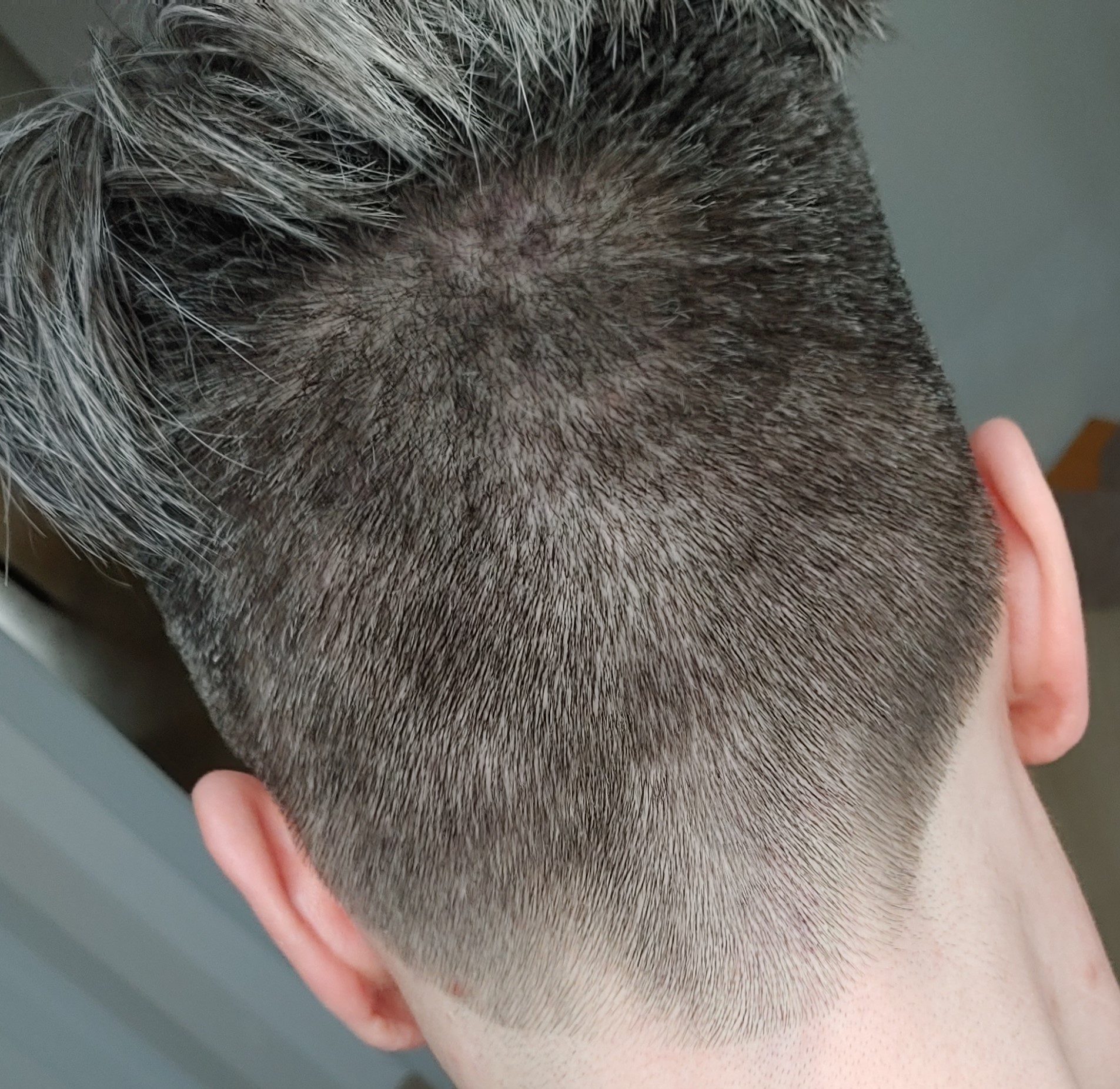 /foren/transplant/index.php/fa/51431/0/