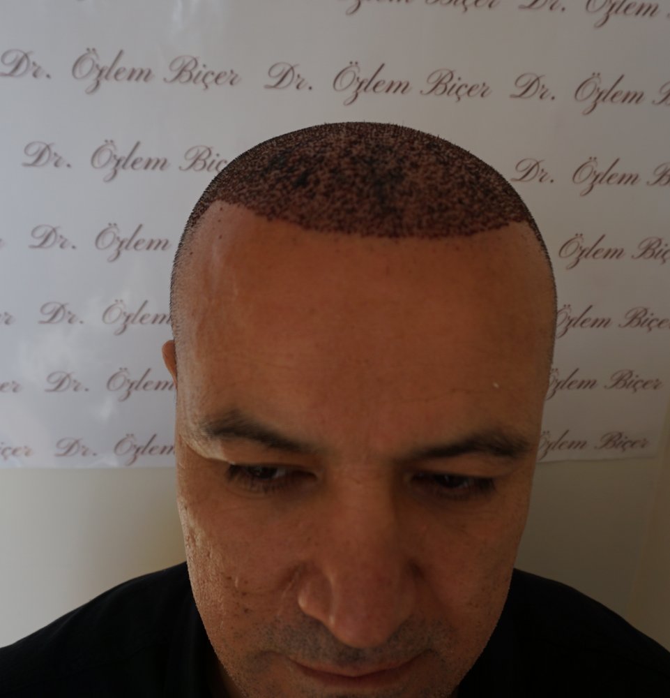 /foren/transplant/index.php/fa/51469/0/