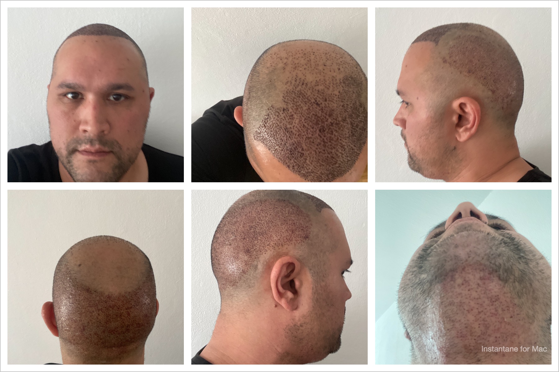 /foren/transplant/index.php/fa/51489/0/