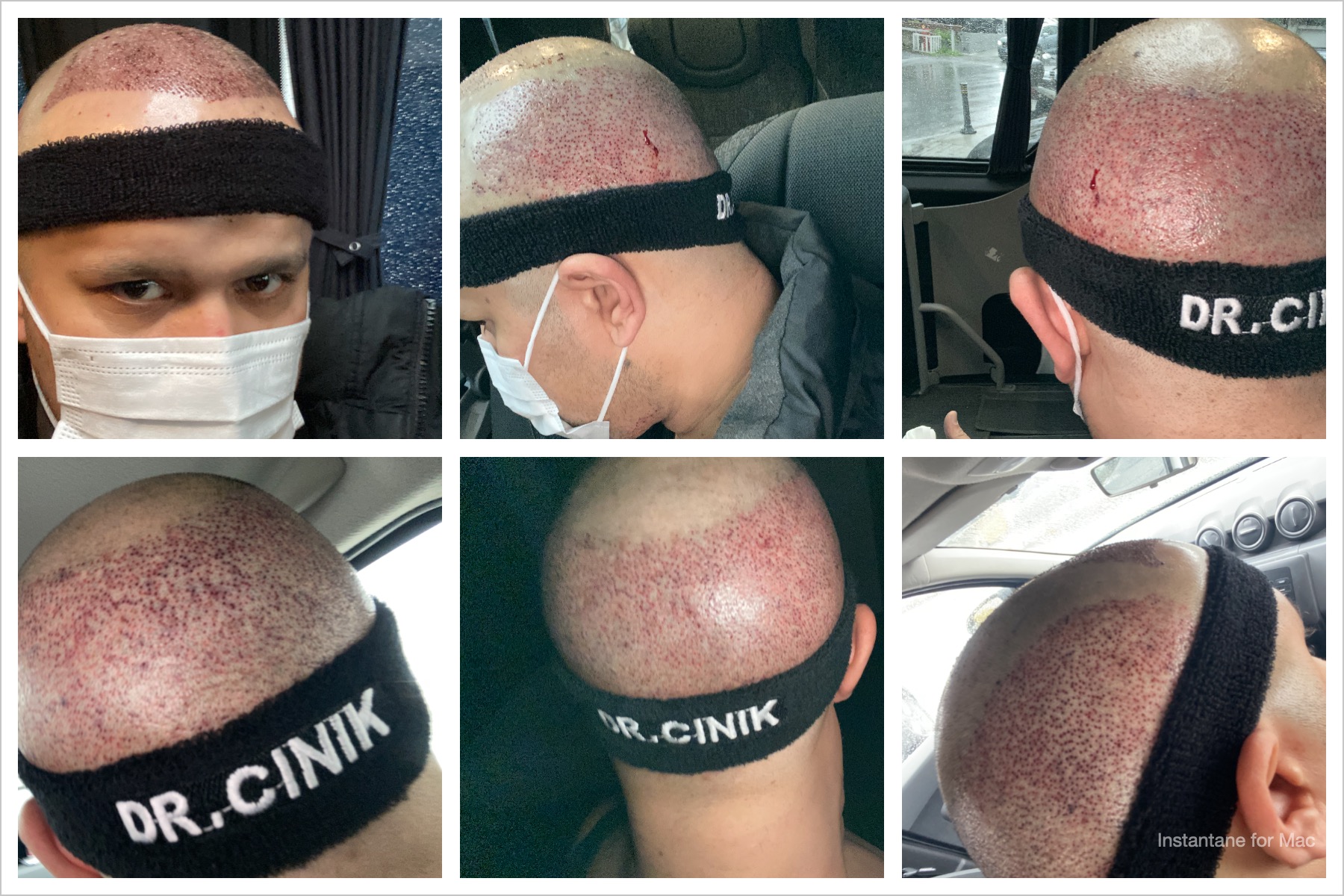 /foren/transplant/index.php/fa/51494/0/