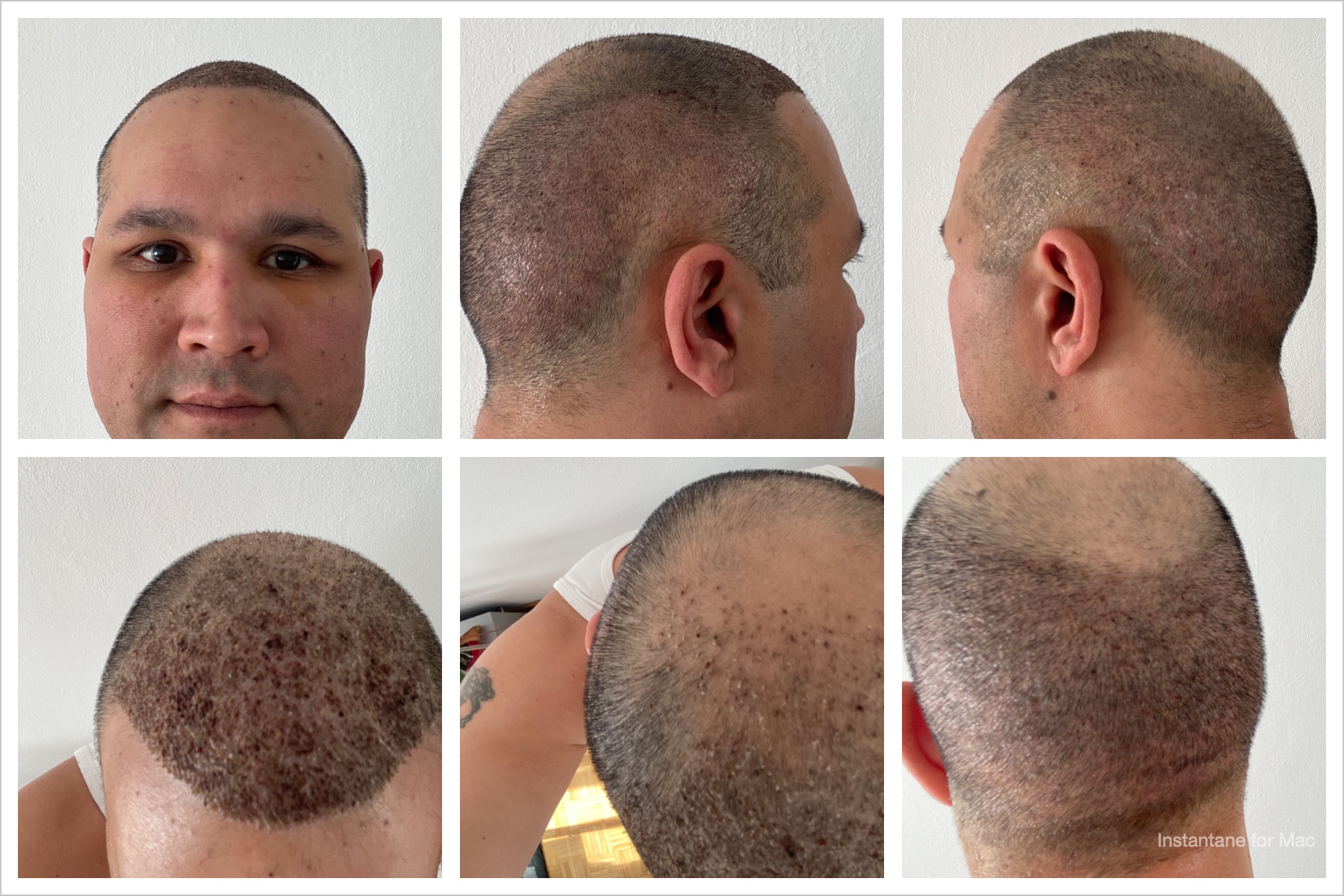 /foren/transplant/index.php/fa/51495/0/