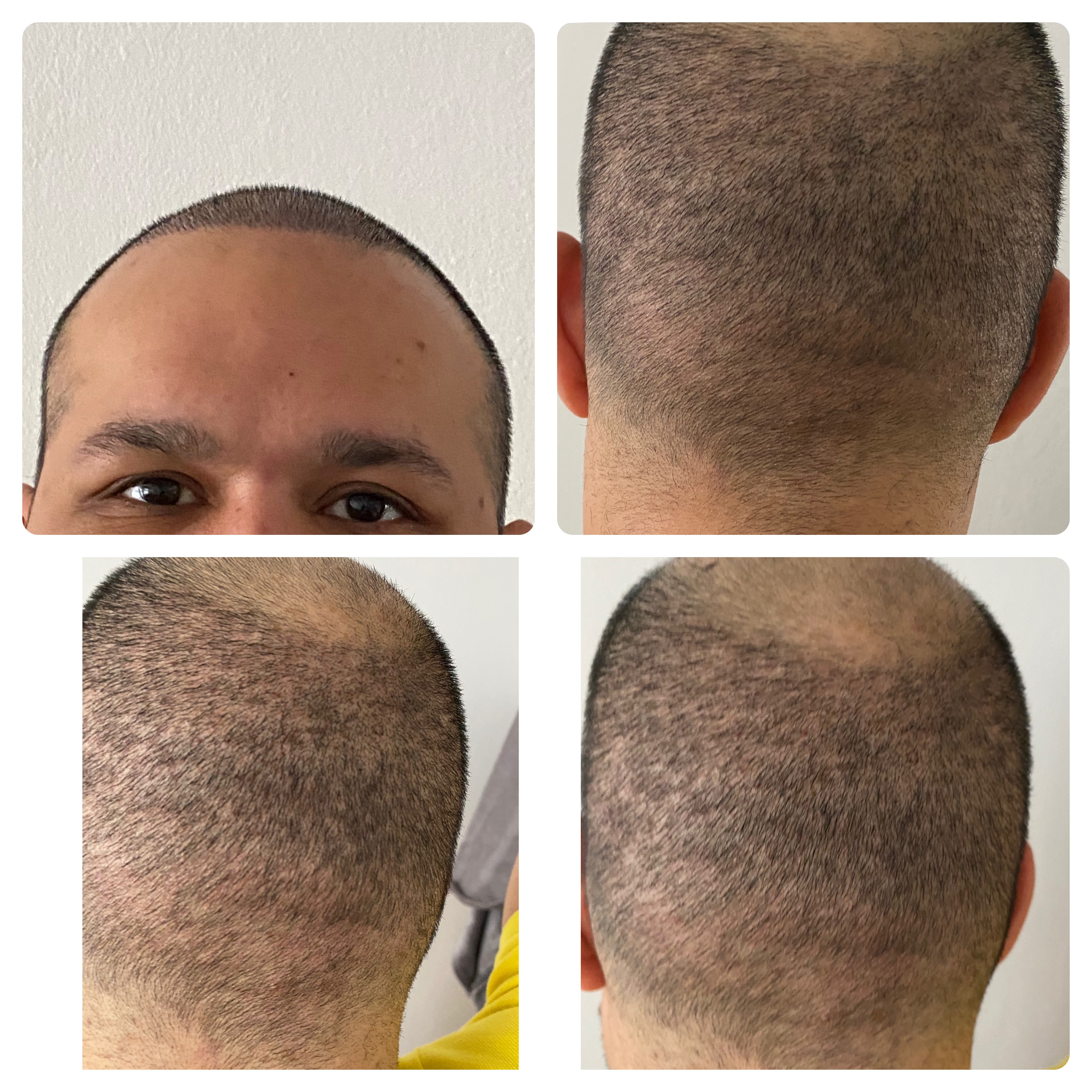 /foren/transplant/index.php/fa/51544/0/