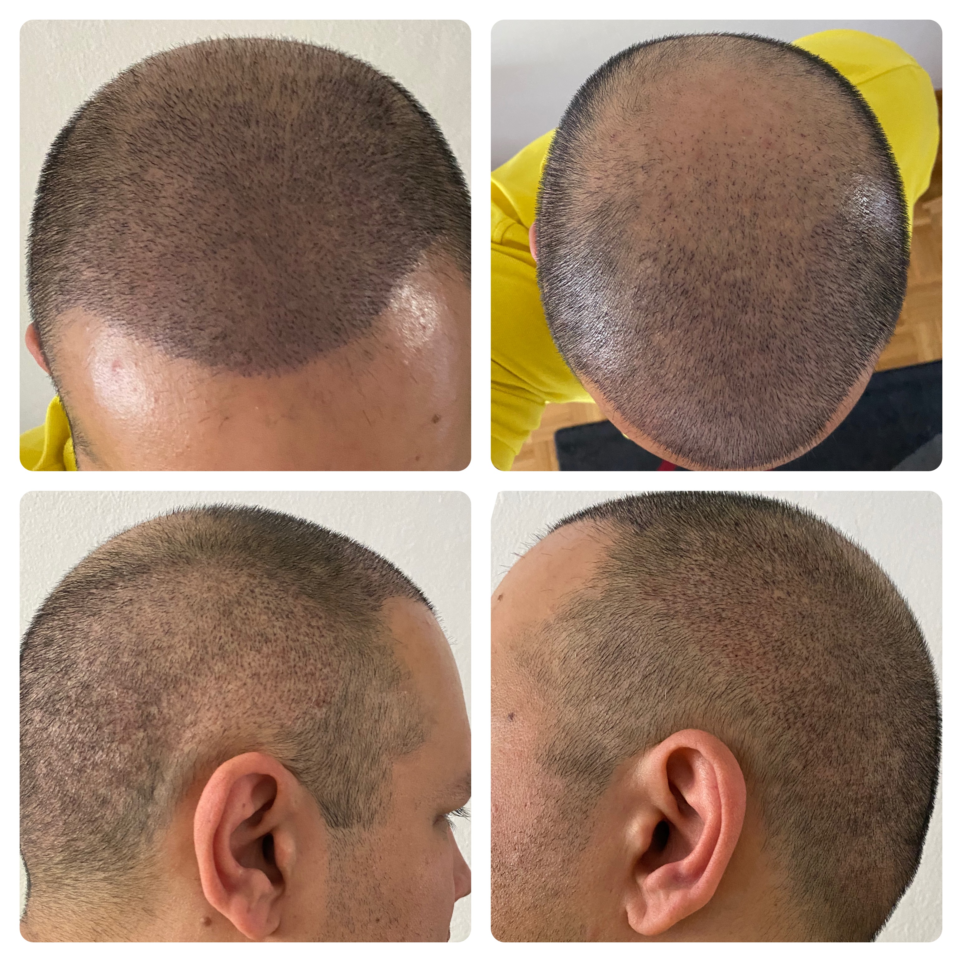 /foren/transplant/index.php/fa/51545/0/