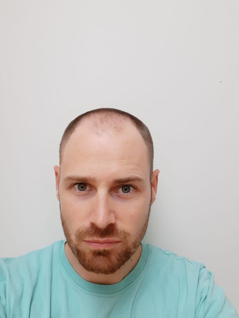 /foren/transplant/index.php/fa/51633/0/