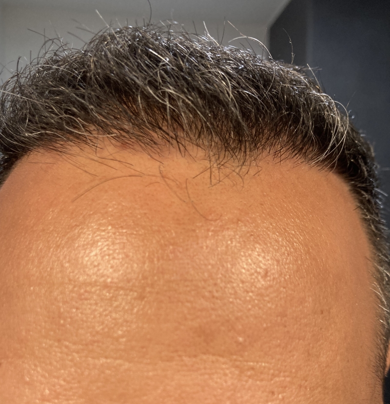 /foren/transplant/index.php/fa/51718/0/