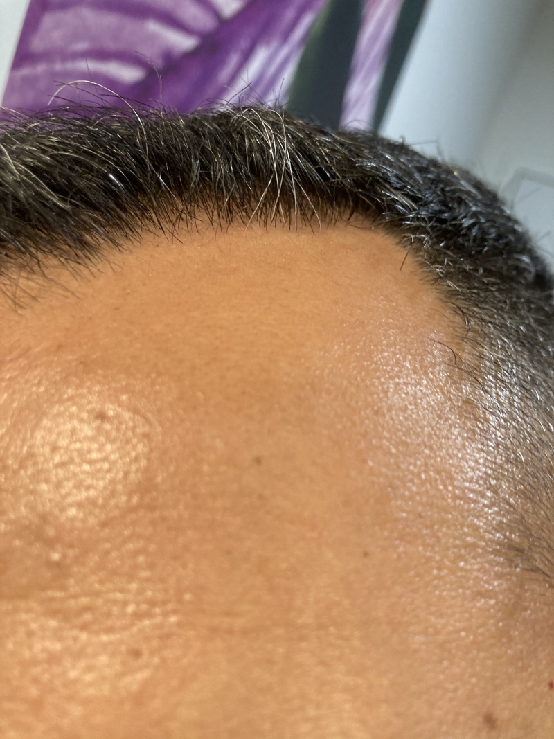 /foren/transplant/index.php/fa/51719/0/