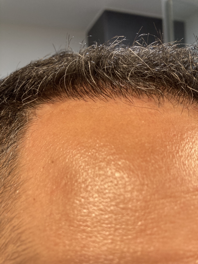 /foren/transplant/index.php/fa/51720/0/