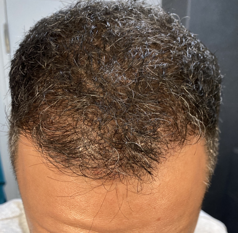 /foren/transplant/index.php/fa/51721/0/