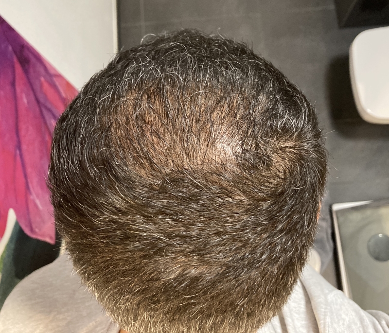 /foren/transplant/index.php/fa/51722/0/