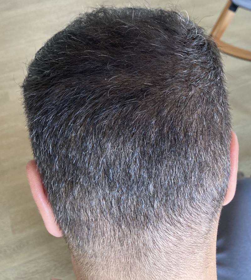 /foren/transplant/index.php/fa/51723/0/