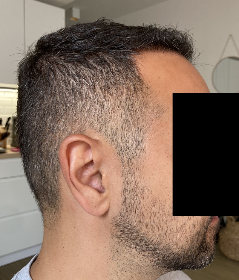 /foren/transplant/index.php/fa/51724/0/