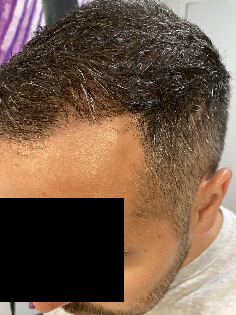 /foren/transplant/index.php/fa/51725/0/