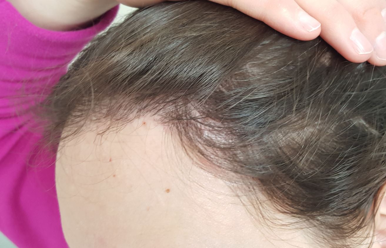 /foren/transplant/index.php/fa/51743/0/