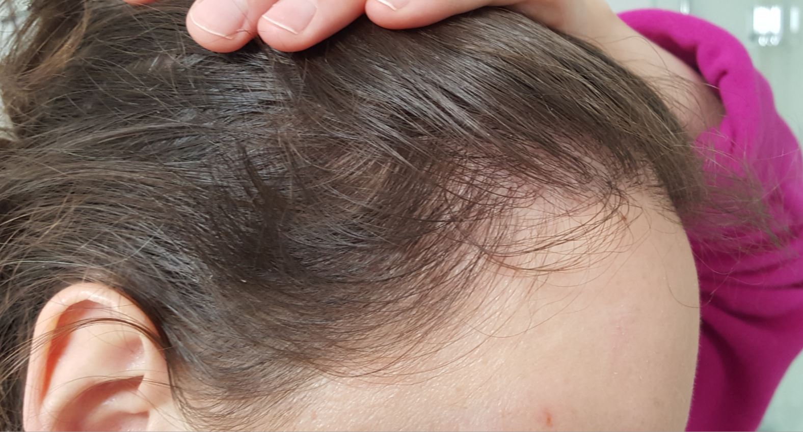 /foren/transplant/index.php/fa/51744/0/