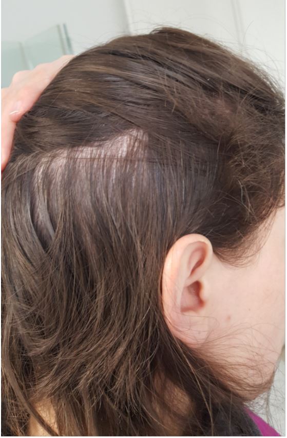 /foren/transplant/index.php/fa/51745/0/