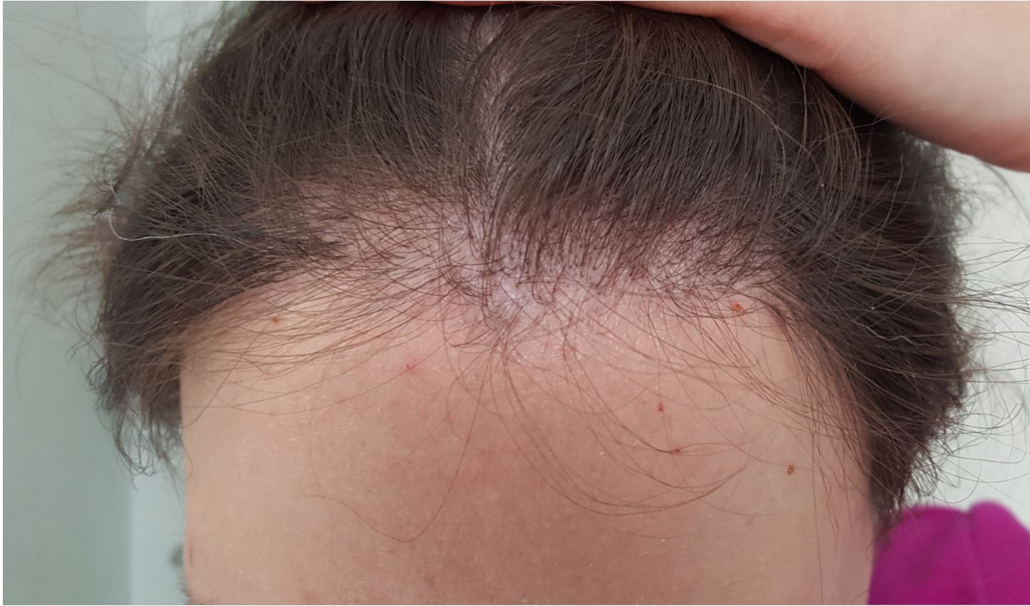 /foren/transplant/index.php/fa/51746/0/