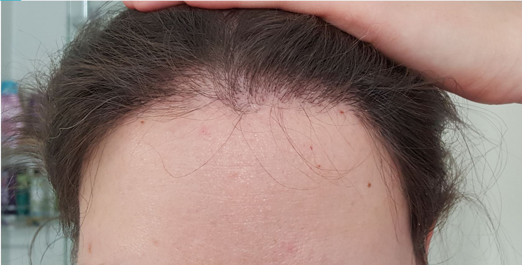 /foren/transplant/index.php/fa/51747/0/