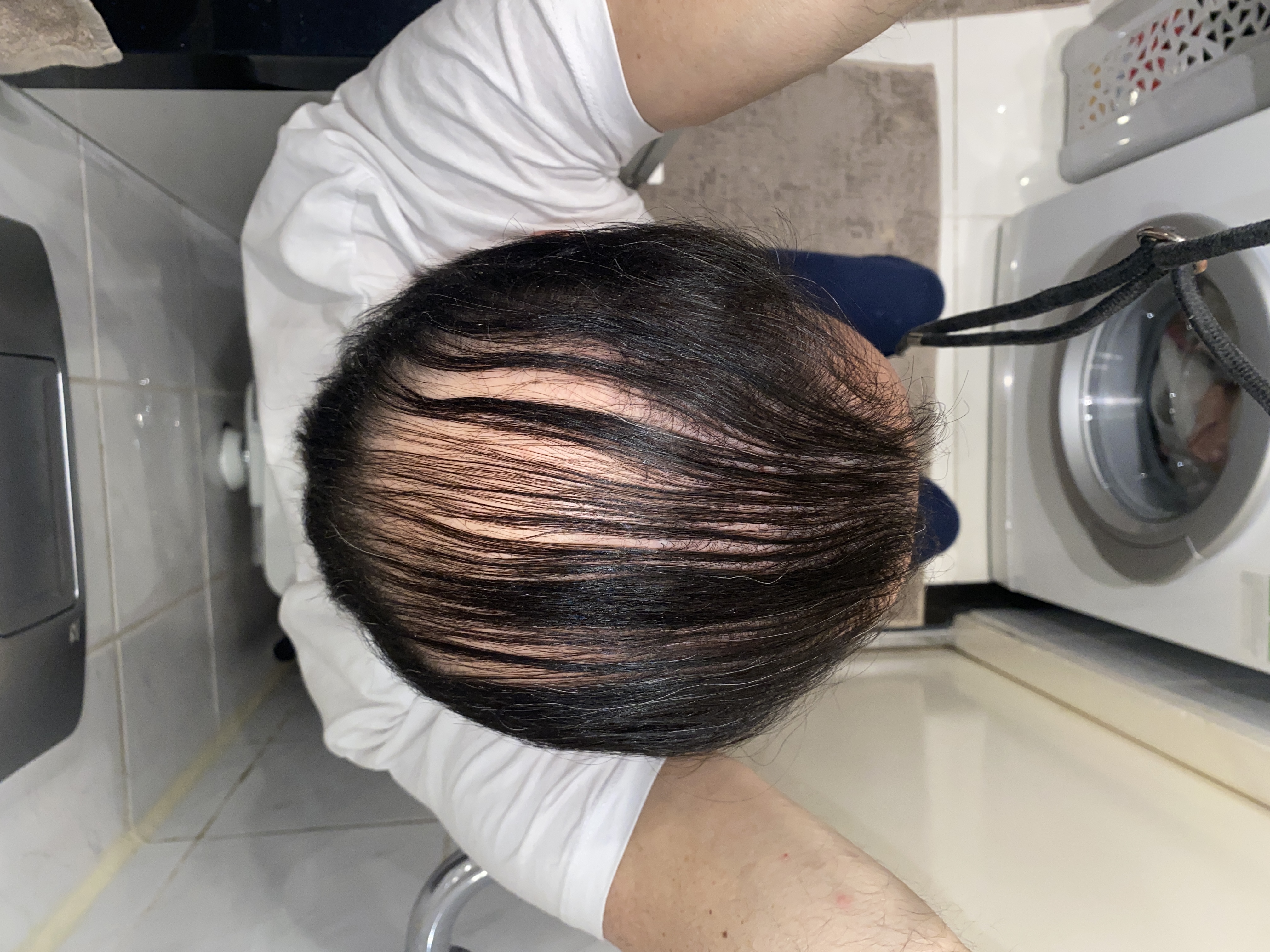 /foren/transplant/index.php/fa/51791/0/