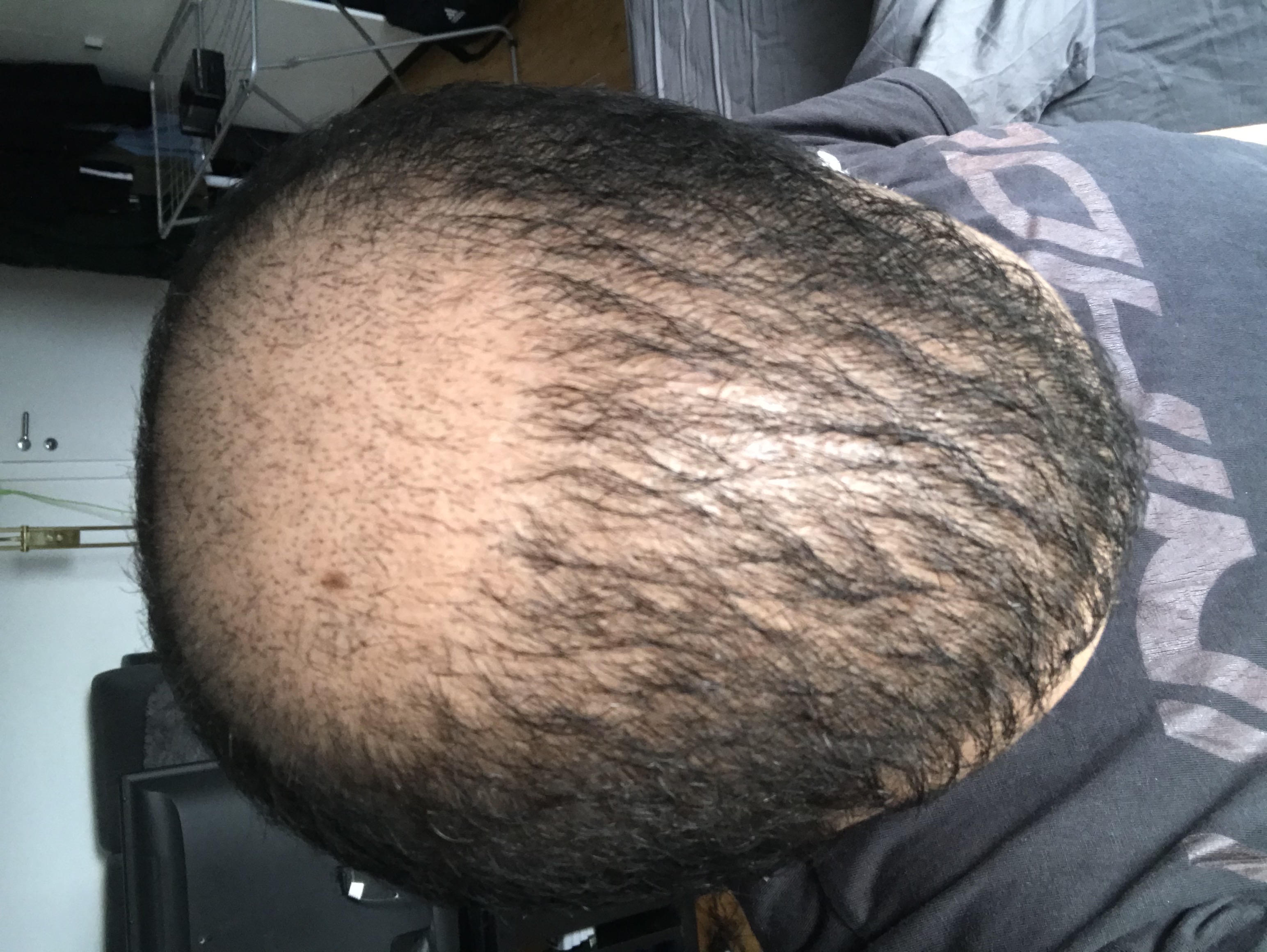 /foren/transplant/index.php/fa/51798/0/