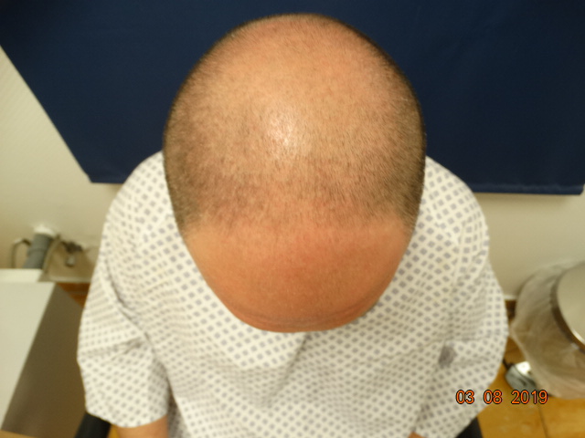 /foren/transplant/index.php/fa/51849/0/