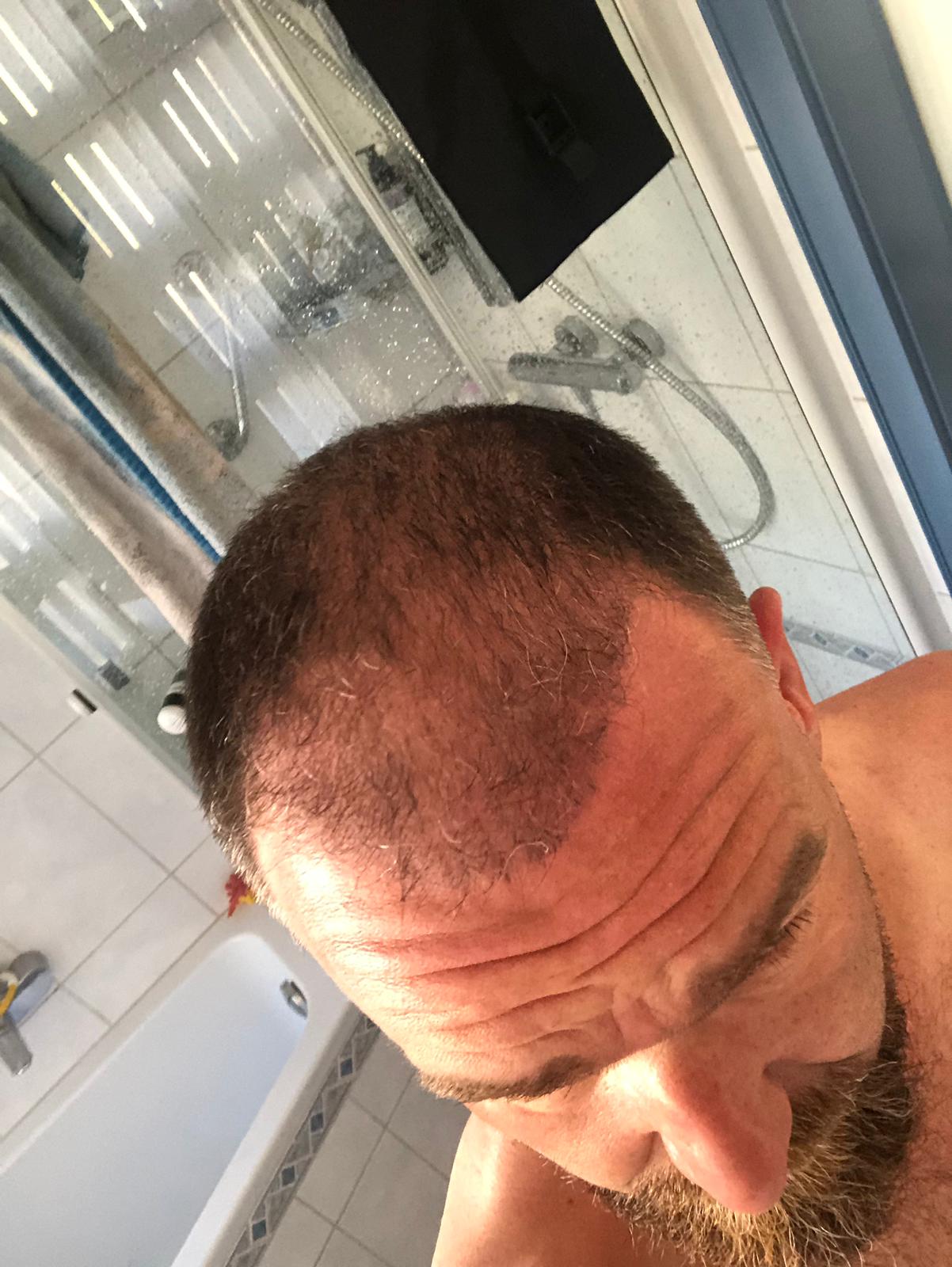 /foren/transplant/index.php/fa/51851/0/