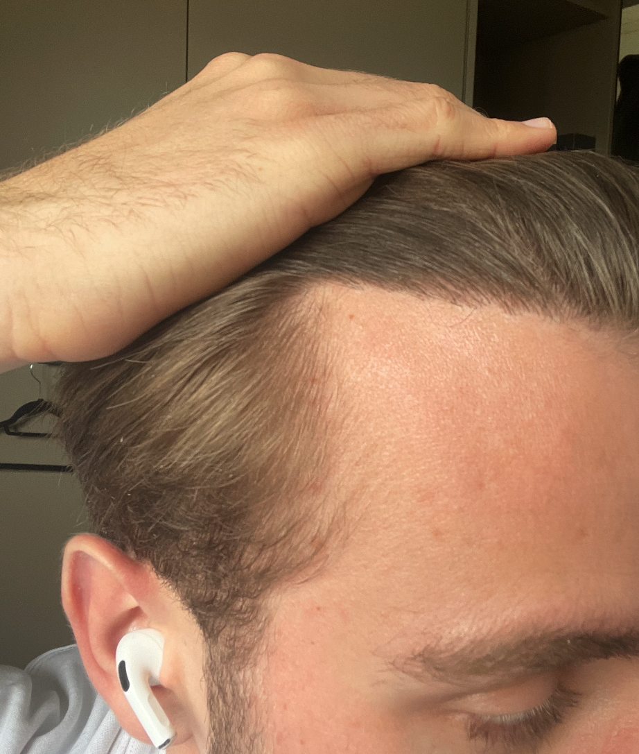 /foren/transplant/index.php/fa/51874/0/