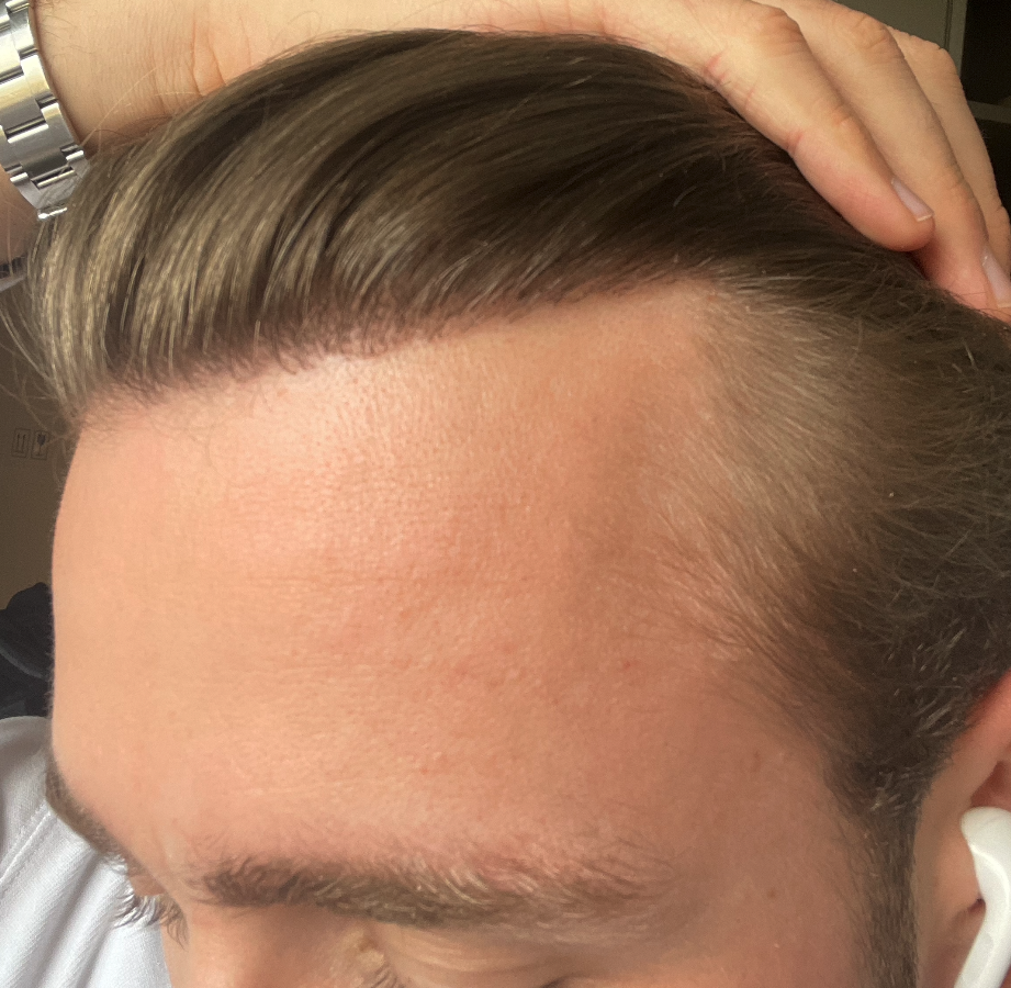 /foren/transplant/index.php/fa/51875/0/