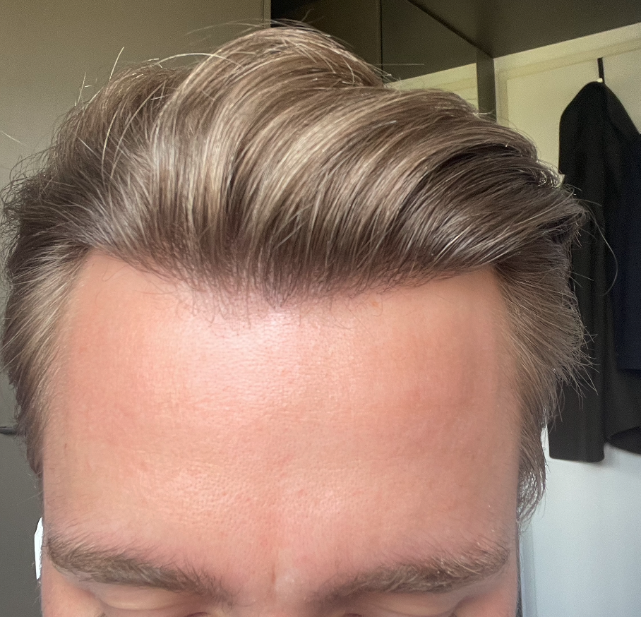 /foren/transplant/index.php/fa/51876/0/