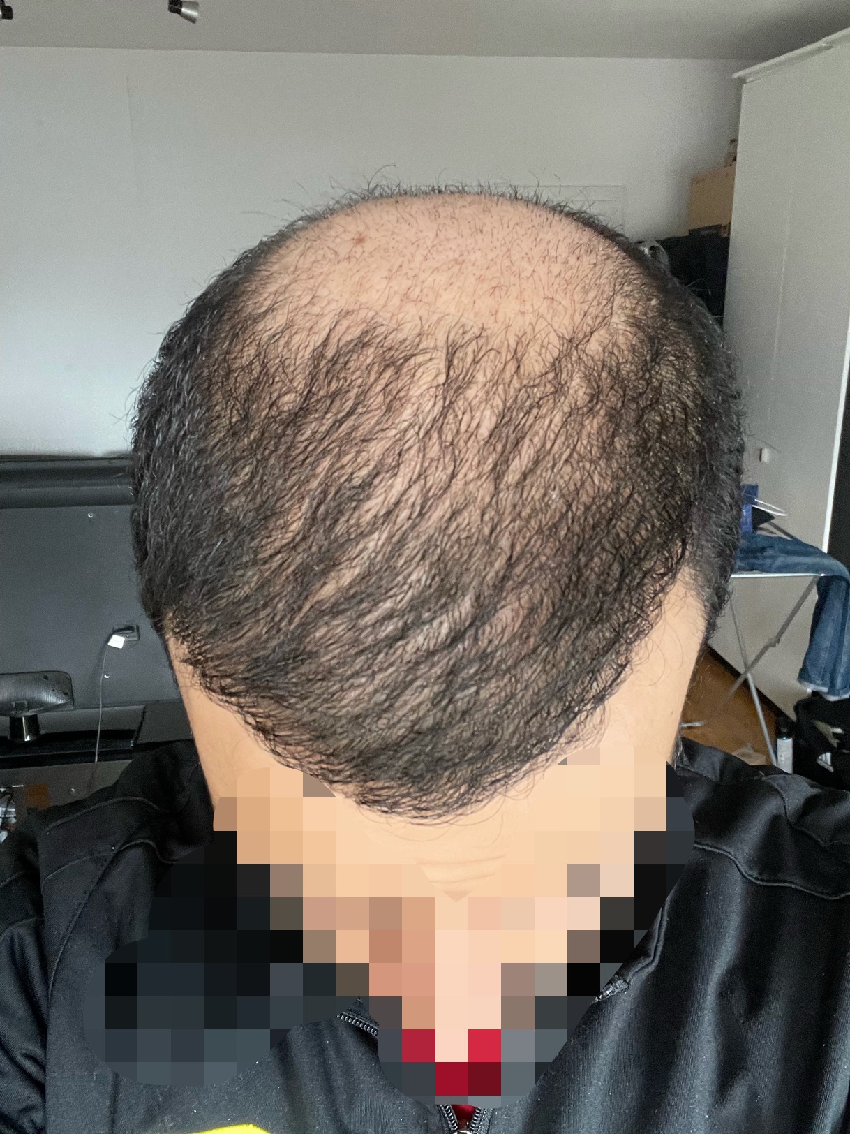 /foren/transplant/index.php/fa/51893/0/