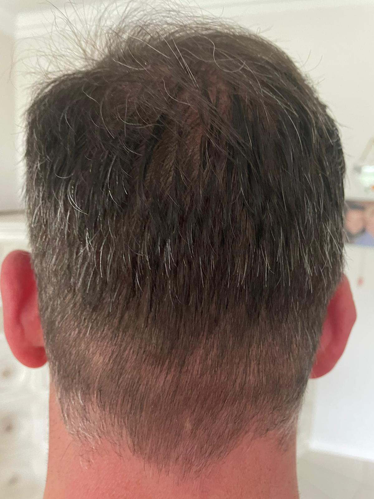 /foren/transplant/index.php/fa/51914/0/