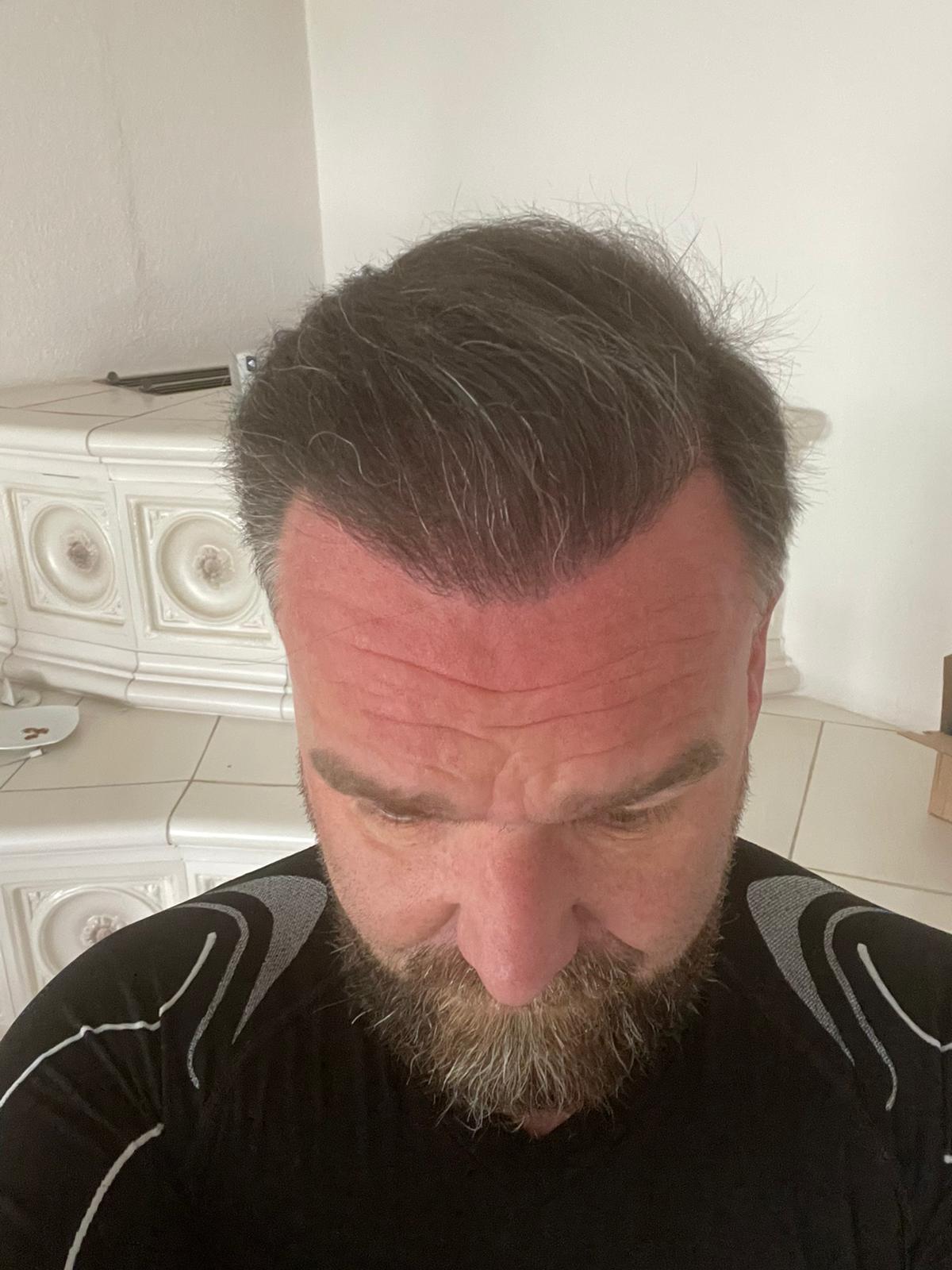 /foren/transplant/index.php/fa/51916/0/