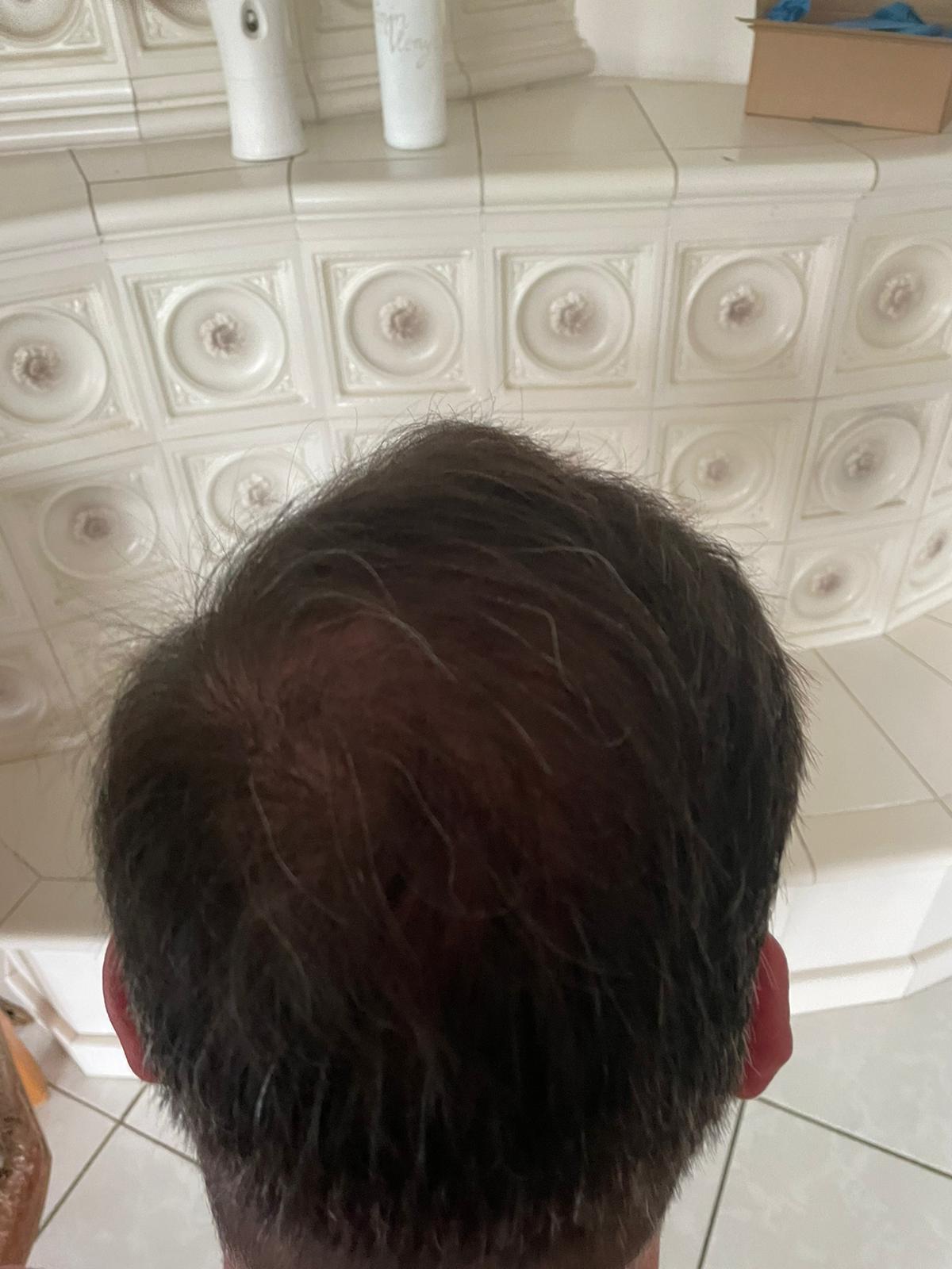 /foren/transplant/index.php/fa/51917/0/