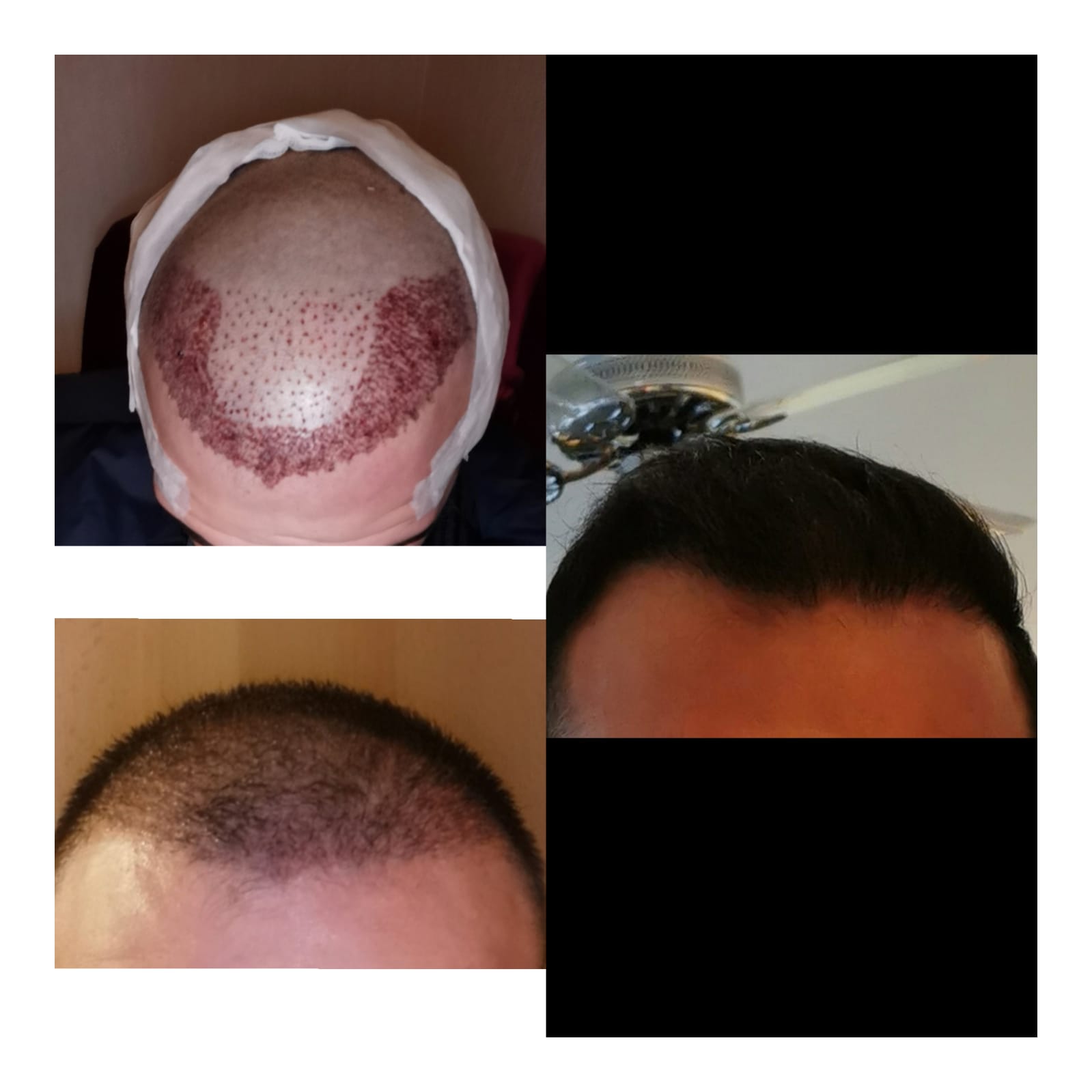 /foren/transplant/index.php/fa/51918/0/