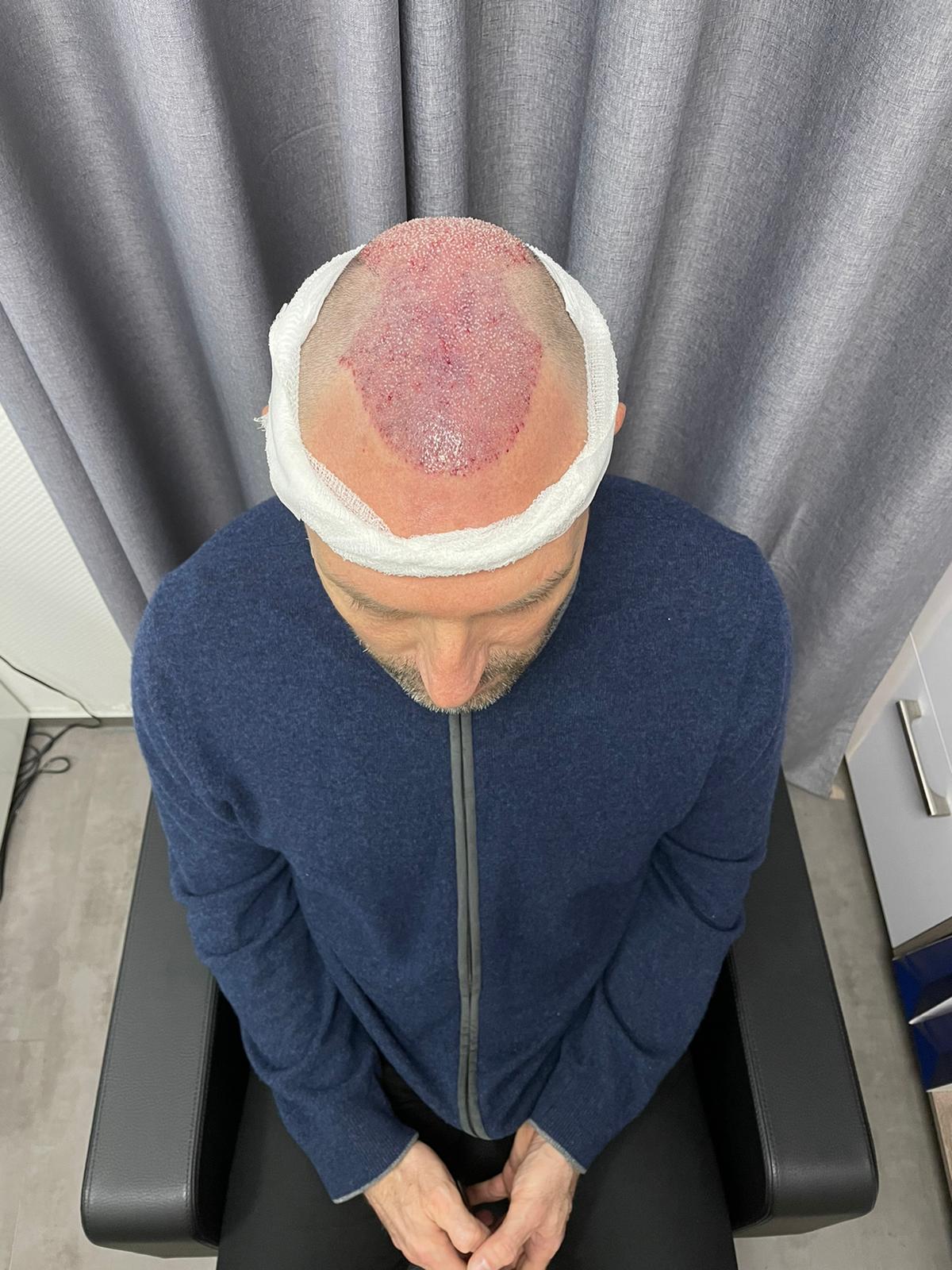 /foren/transplant/index.php/fa/51920/0/