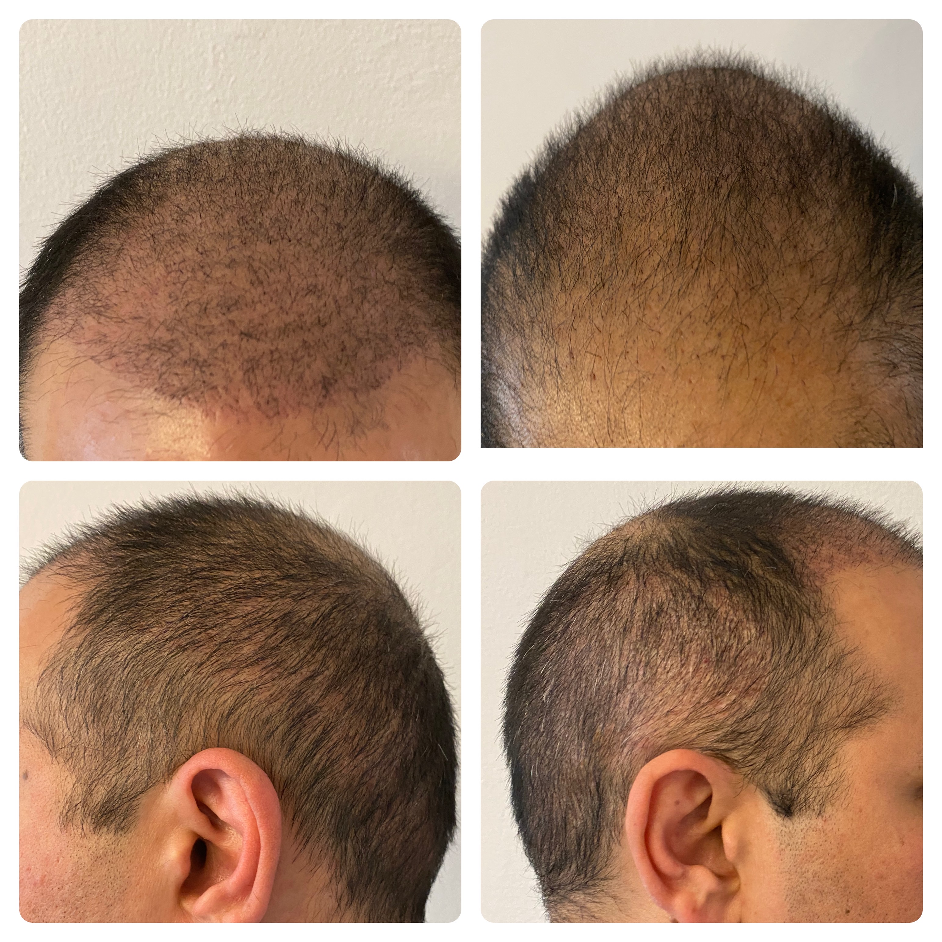 /foren/transplant/index.php/fa/51940/0/