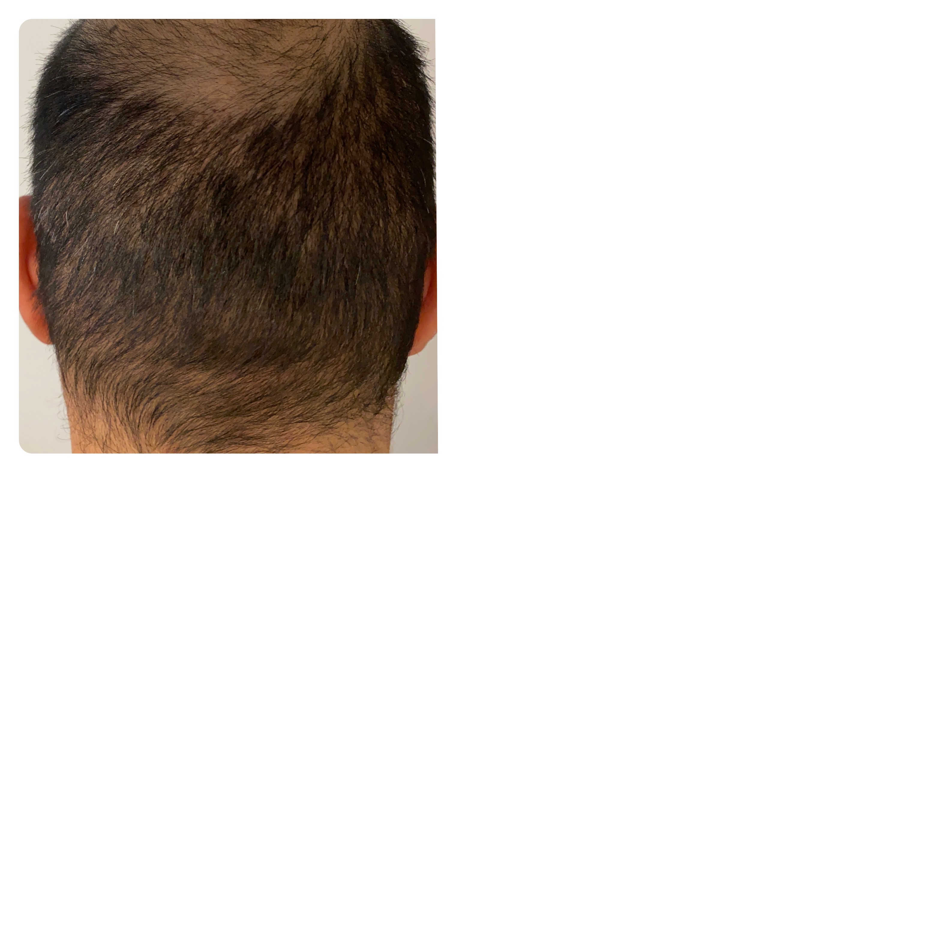 /foren/transplant/index.php/fa/51941/0/