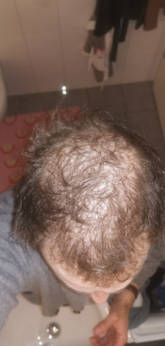 /foren/transplant/index.php/fa/51991/0/