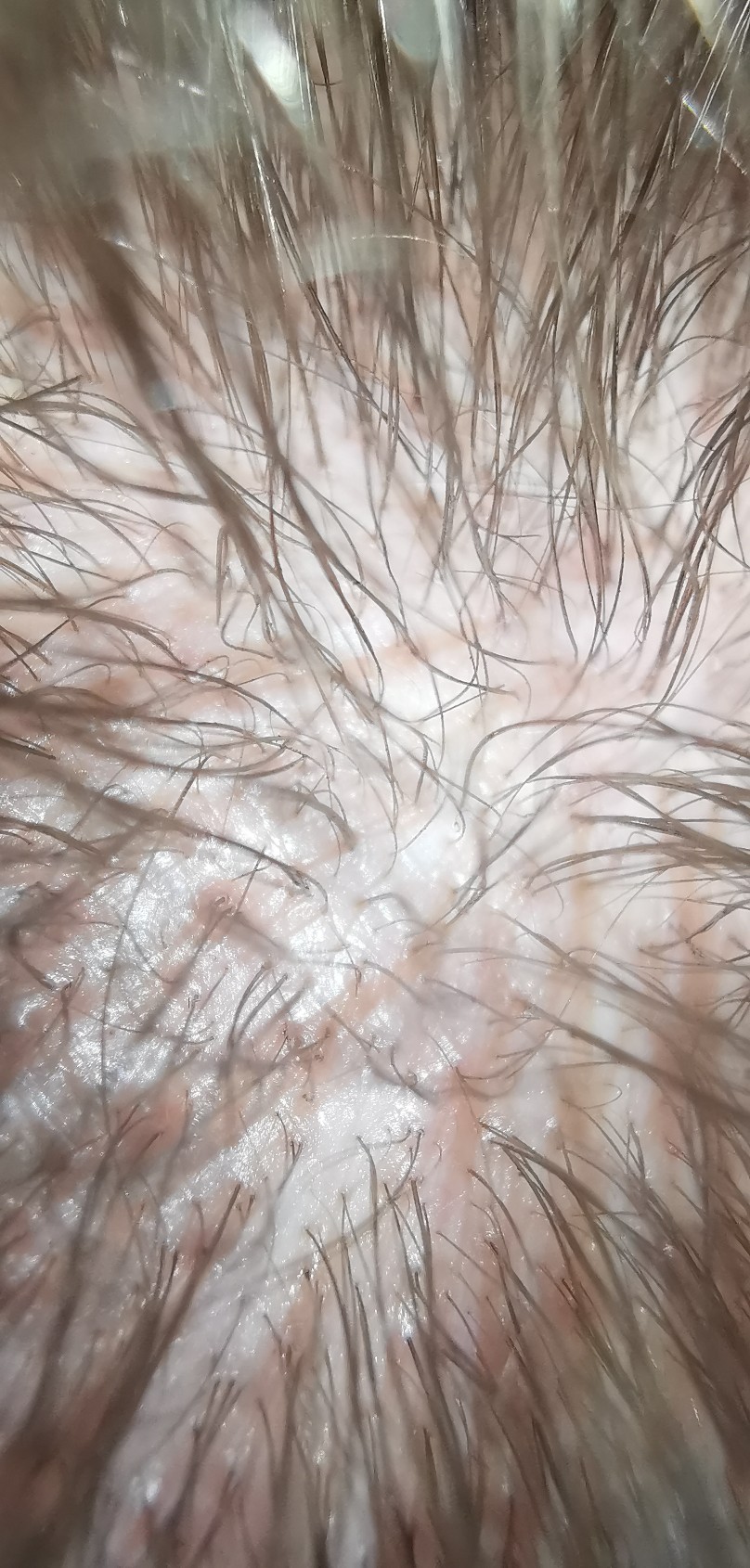 /foren/transplant/index.php/fa/51992/0/