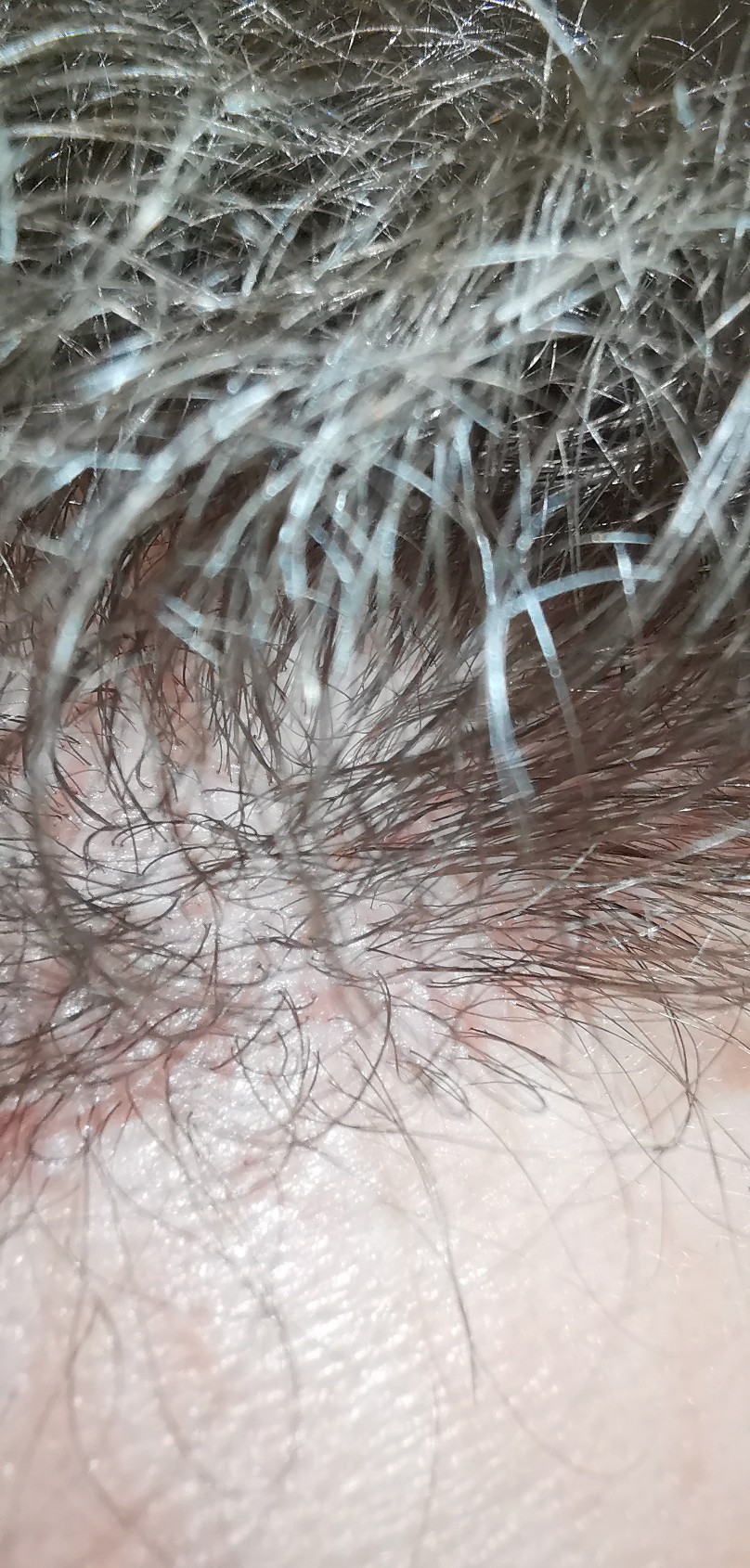 /foren/transplant/index.php/fa/51993/0/