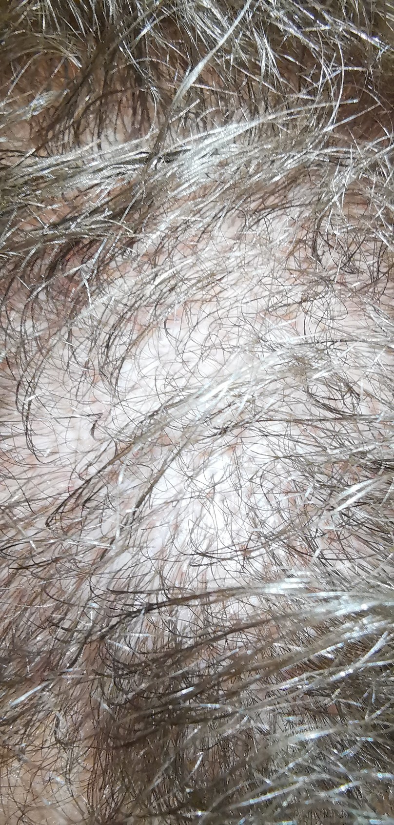 /foren/transplant/index.php/fa/51994/0/