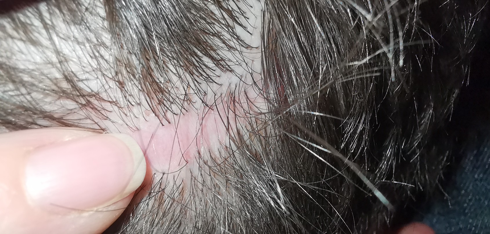 /foren/transplant/index.php/fa/52029/0/