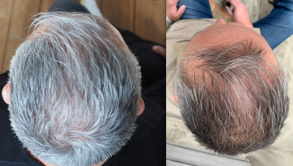 /foren/transplant/index.php/fa/52101/0/