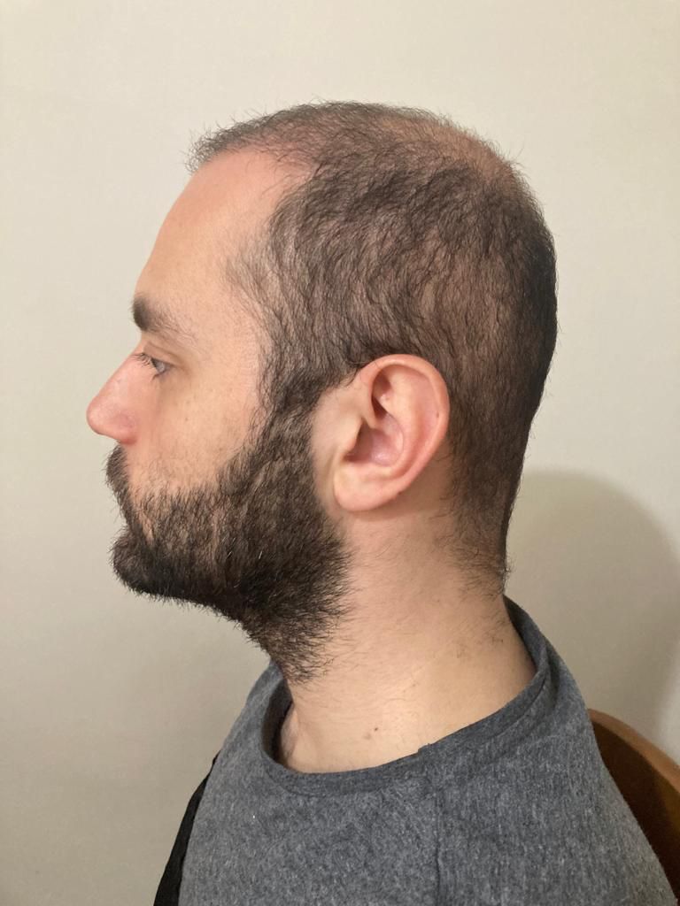 /foren/transplant/index.php/fa/52109/0/