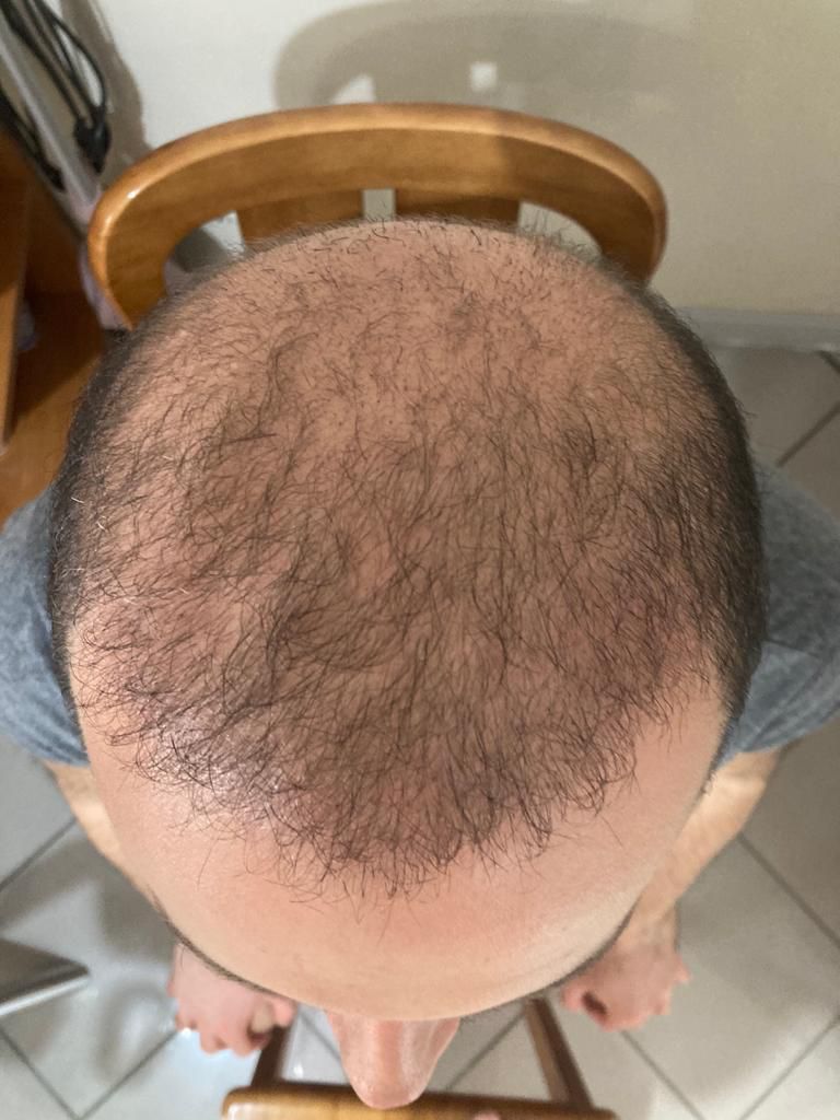 /foren/transplant/index.php/fa/52112/0/