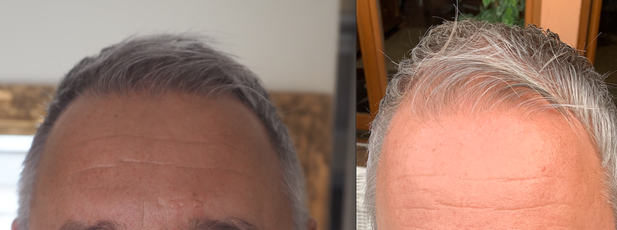 /foren/transplant/index.php/fa/52113/0/