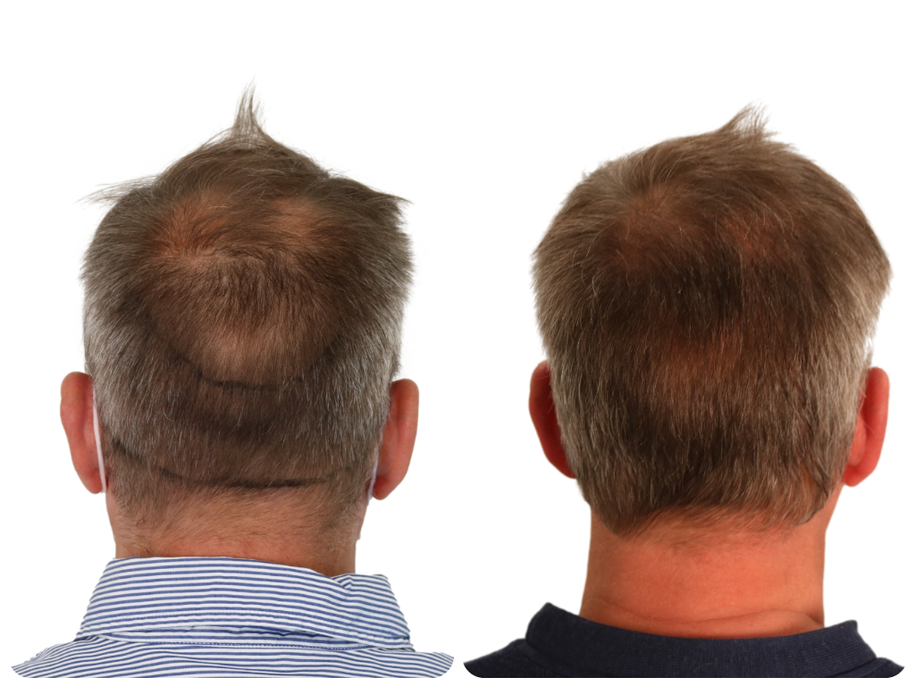 /foren/transplant/index.php/fa/52124/0/